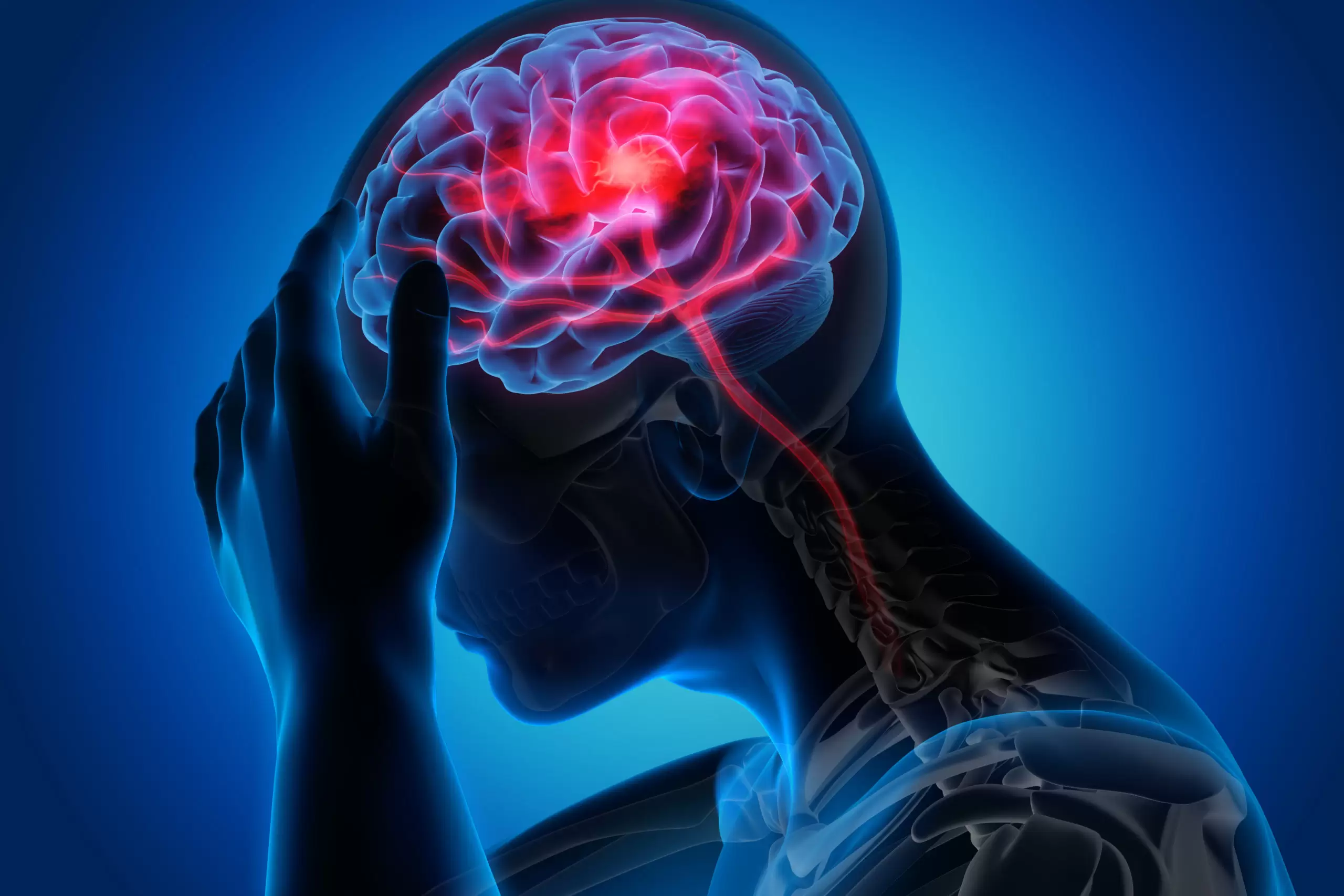 Accidentul Vascular Cerebral: Tot ce Trebuie să Știi